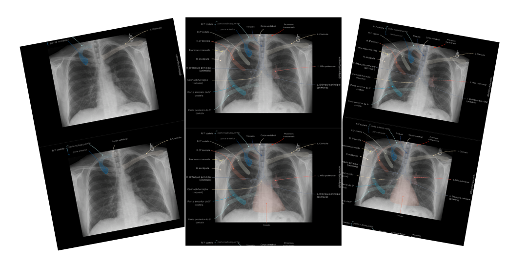 Anatomia Radiografia